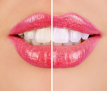 Dr oliviya heart, Virginia Biological Dentistry Describing Benefits Of Cosmetic Dentistry