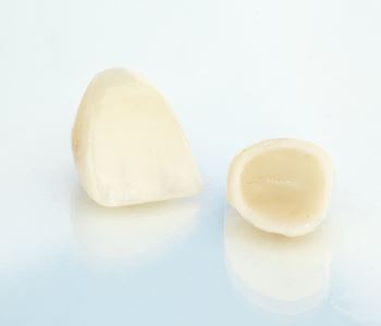 cerec one day crown from dentist in richmond, va