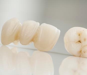 Glen Allen area dentist explains dental bridges