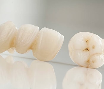 Are same-day crowns as good as lab created restorations near me in Glen Allen?
