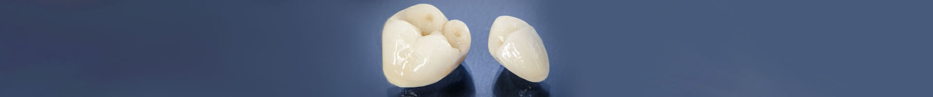 Same Day CEREC Crowns Glen Allen VA