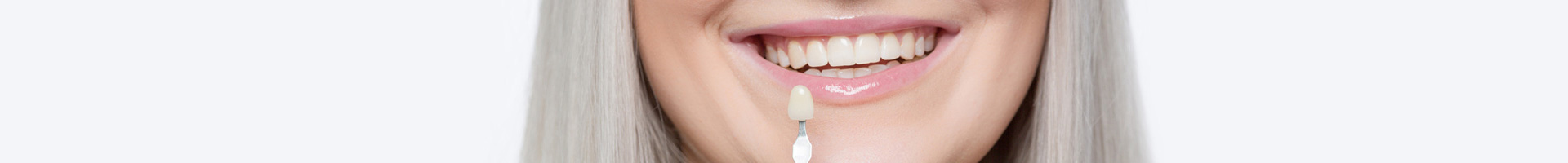 Porcelain Dental Veneers