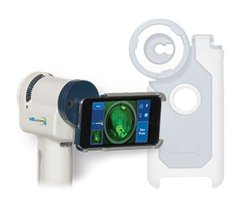 Oral cancer screening device Glen Allen, VA