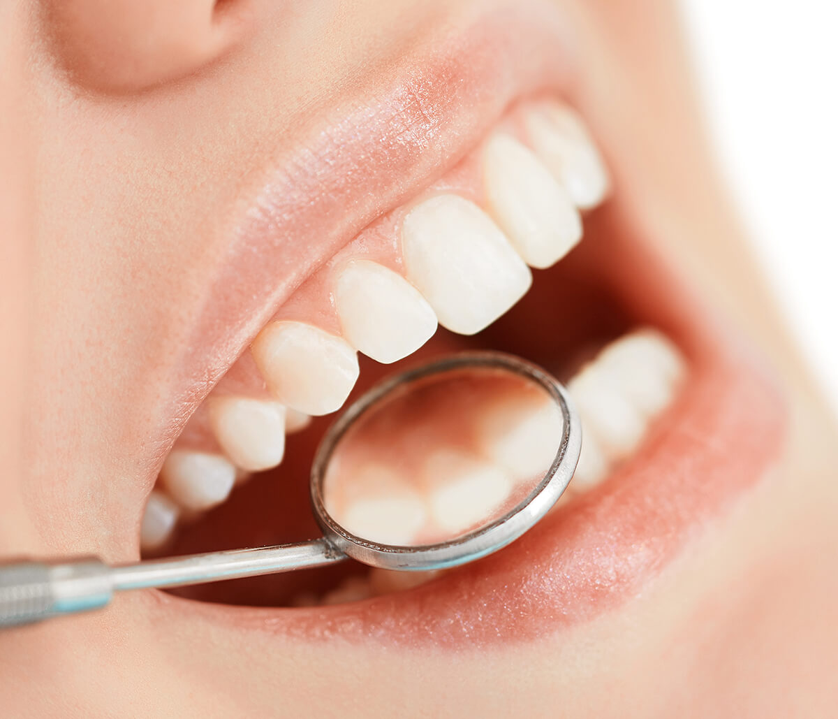 What You Need To Know About BPA in Fillings and Why You Should Choose BPA-Free Fillings