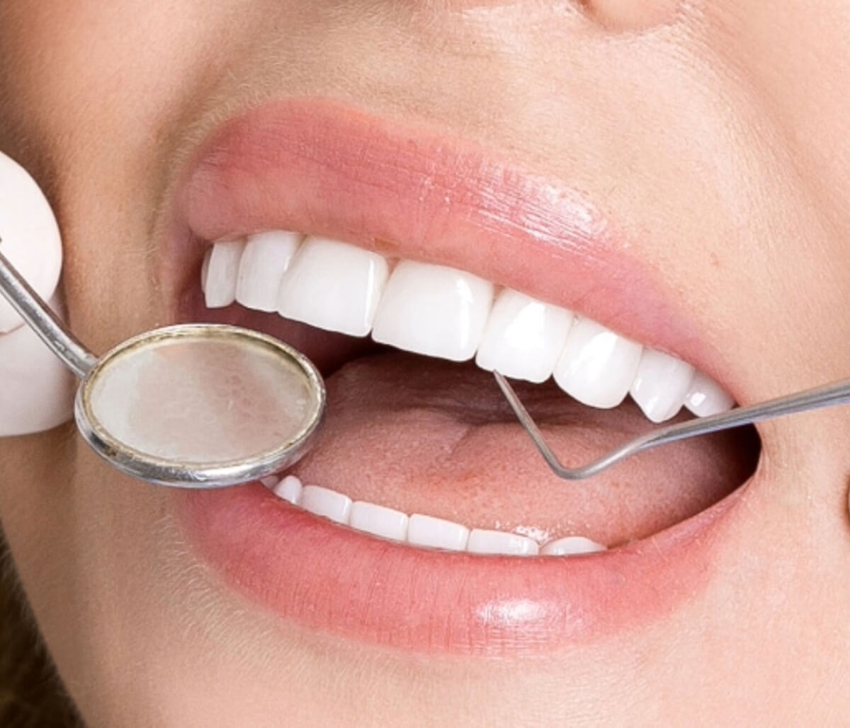 What You Can Expect If You Do Not Visit Your Dentist for Regular Teeth Cleaning Services