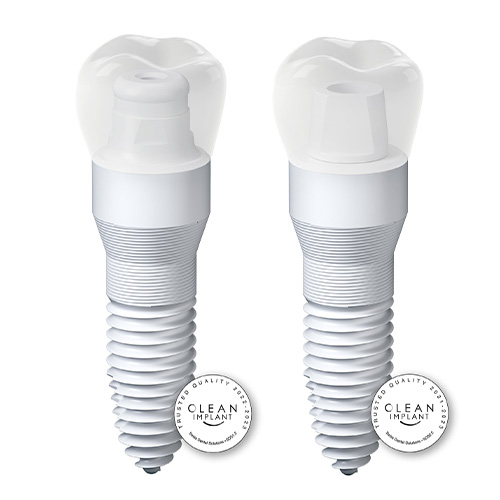 The Benefits of SDS Ceramic Implants
