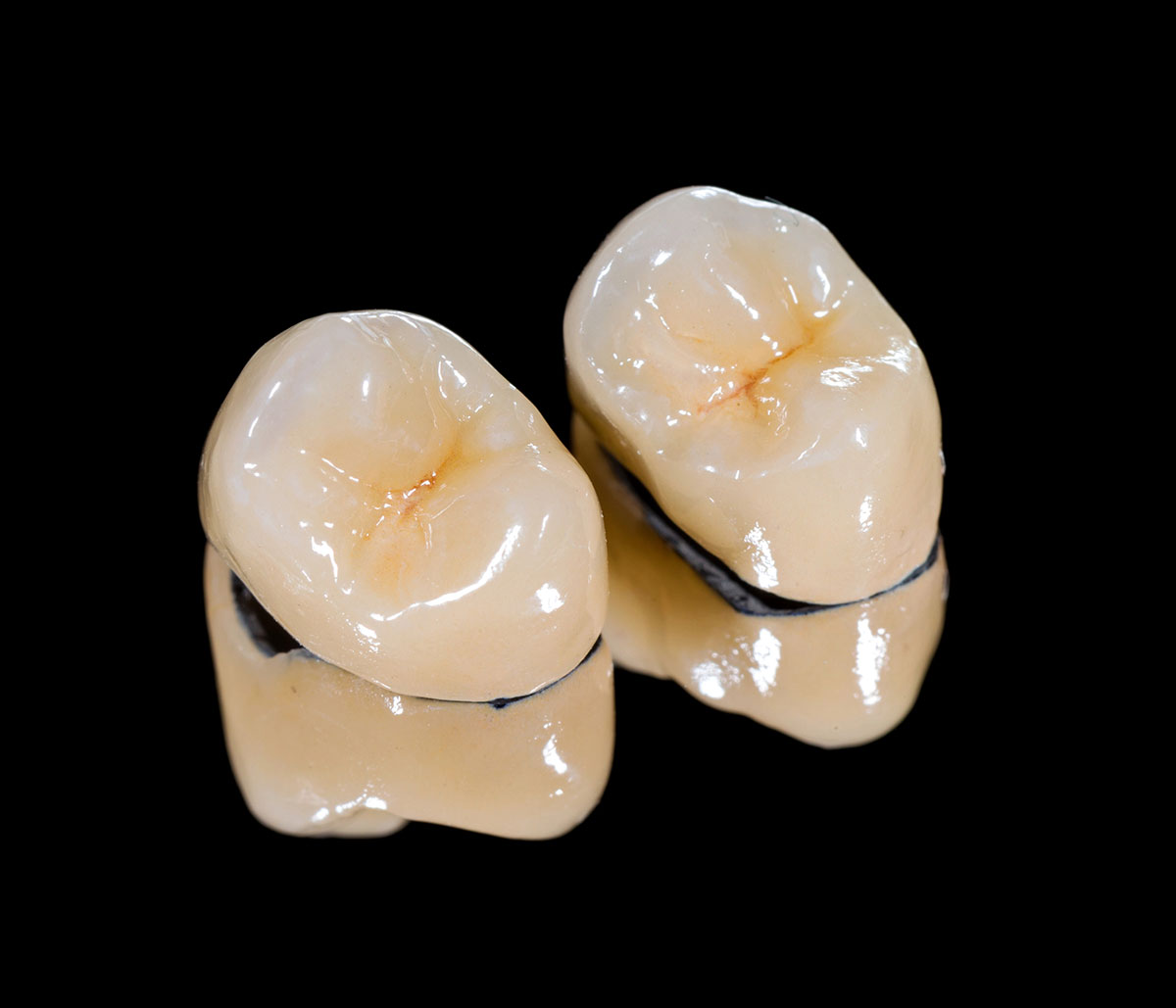 Experience Convenient Dental Care: Your Guide to CEREC Same-day Ceramic Crowns at Virginia Biological Dentistry
