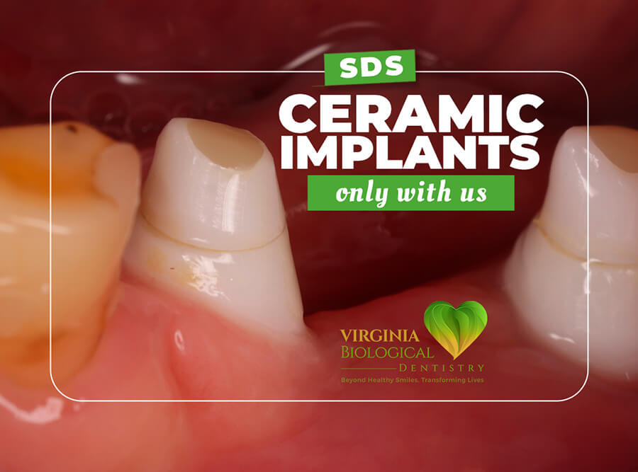 SDS (Swiss Dental Solutions) Ceramic Implants Banner -3
